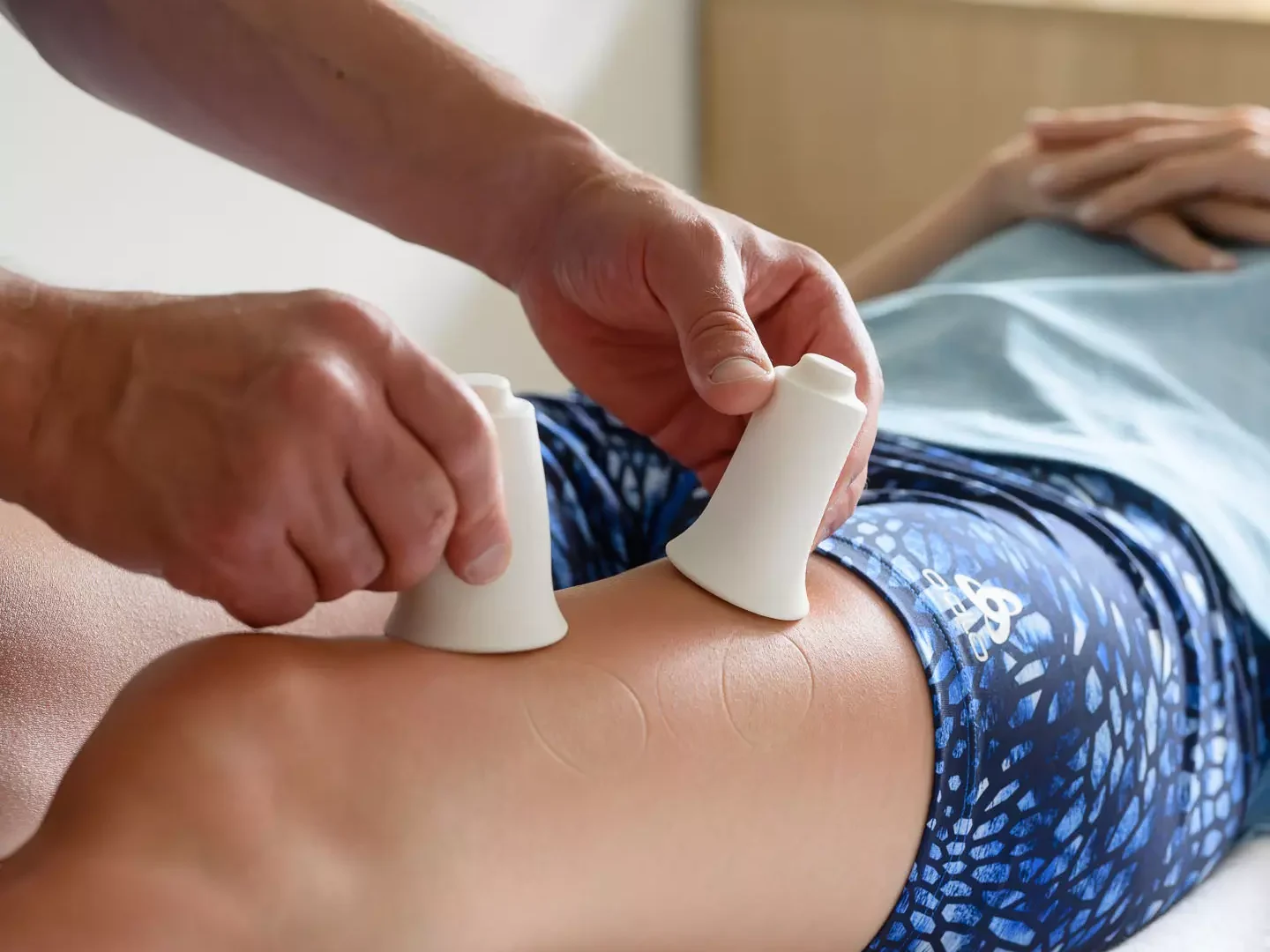 Therapeutische Schröpfmassage mit Silikon-Cups am Oberschenkel zur Förderung der Durchblutung und Faszienbehandlung im Bärenhof.