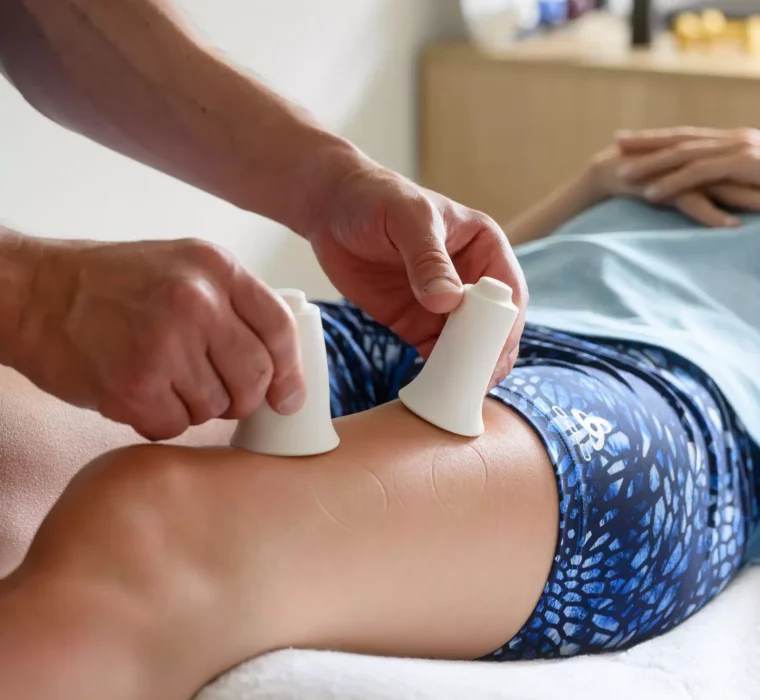 Therapeutische Schröpfmassage mit Silikon-Cups am Oberschenkel zur Förderung der Durchblutung und Faszienbehandlung im Bärenhof.